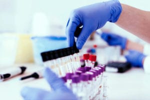 technician Seeing sample of blood