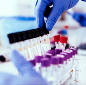 A pathologist putting blood sample in tray