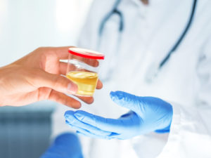 A patient giving his urine for alcohol test