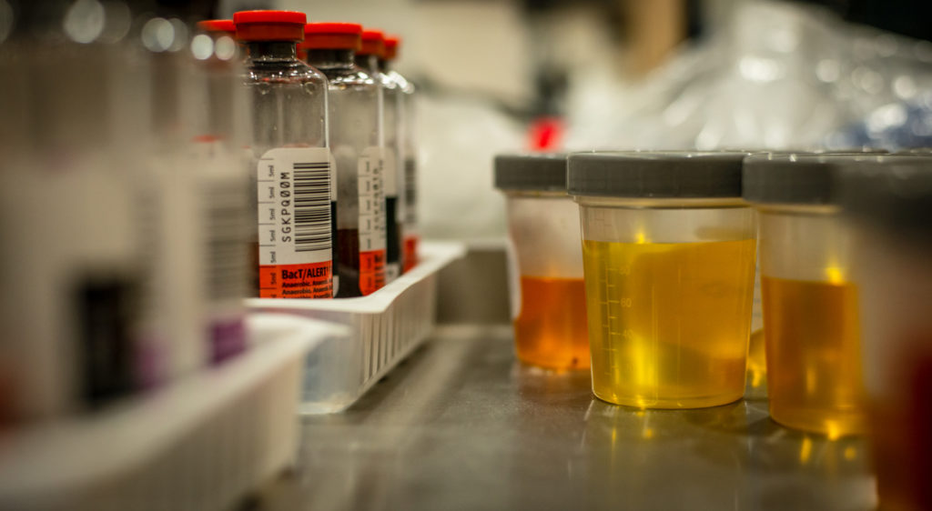 Drug Testing