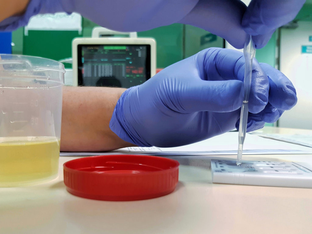 Urine drug test