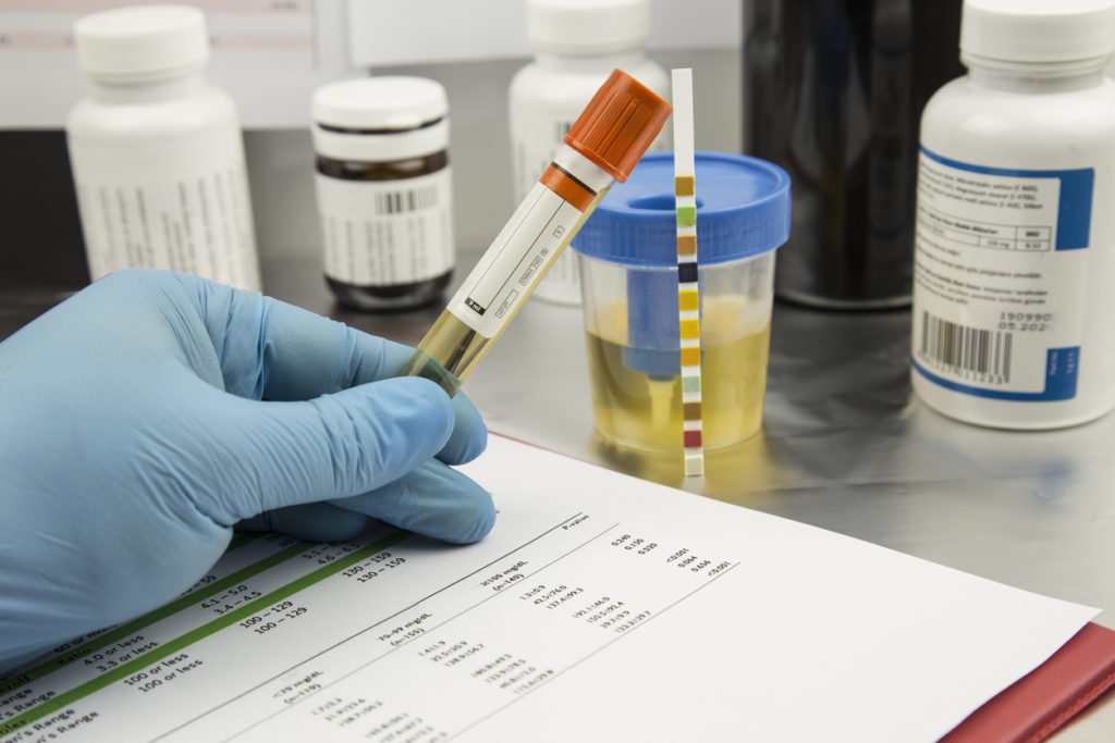 urine analysis in calibration strip .