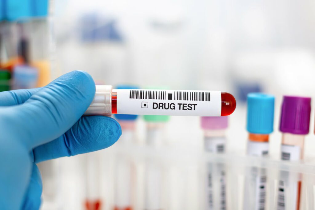 Hand doctor holding urine and blood tube test for analysis for drug