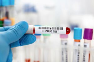 Hand doctor holding urine and blood tube test for analysis for drug