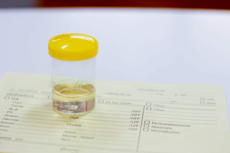 Urine sample for drug testing Work Partners, PLLC