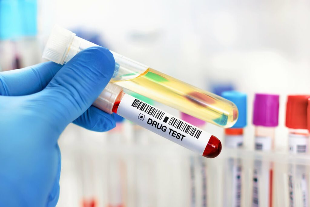 A doctor's hand holds a urinalysis and blood sample for pre-employment drug and alcohol testing in the laboratory.