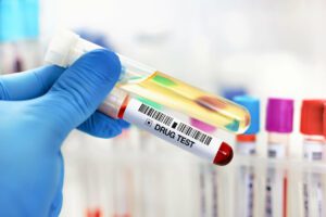 A doctor's hand holds a urinalysis and blood sample for pre-employment drug and alcohol testing in the laboratory.