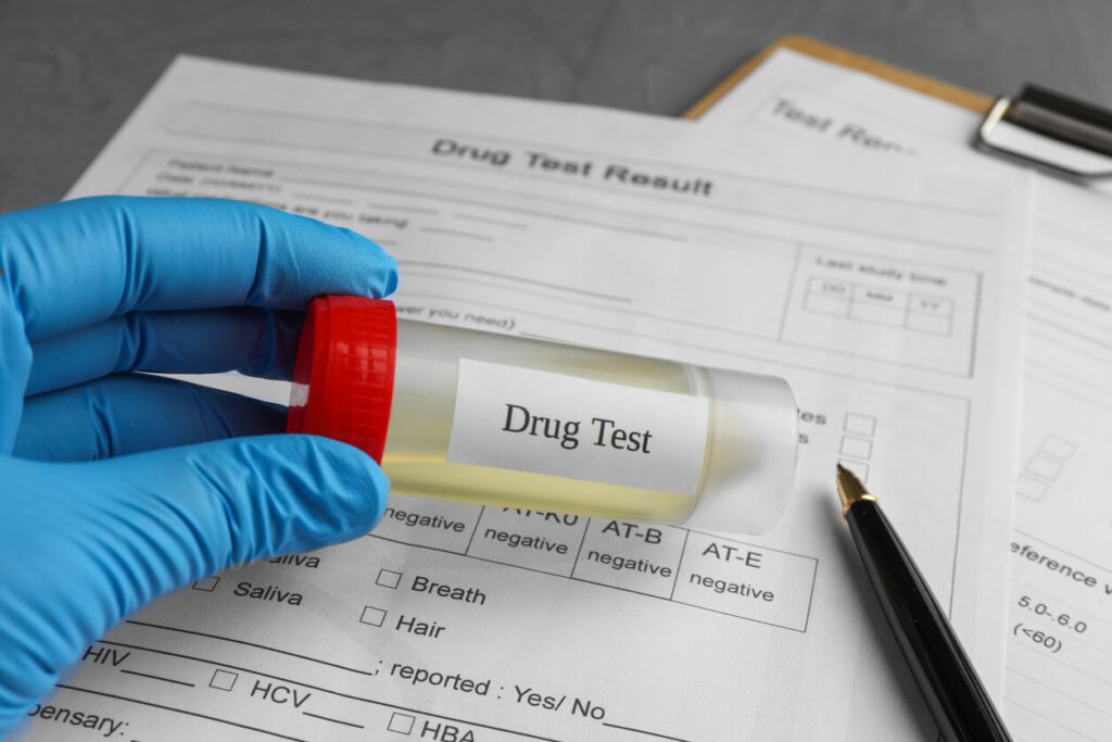 Laboratory worker holding container with urine sample over medical forms on table during drug test.